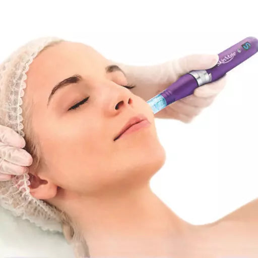 Why You Should Introduce Microneedling to Your Salon in 2025