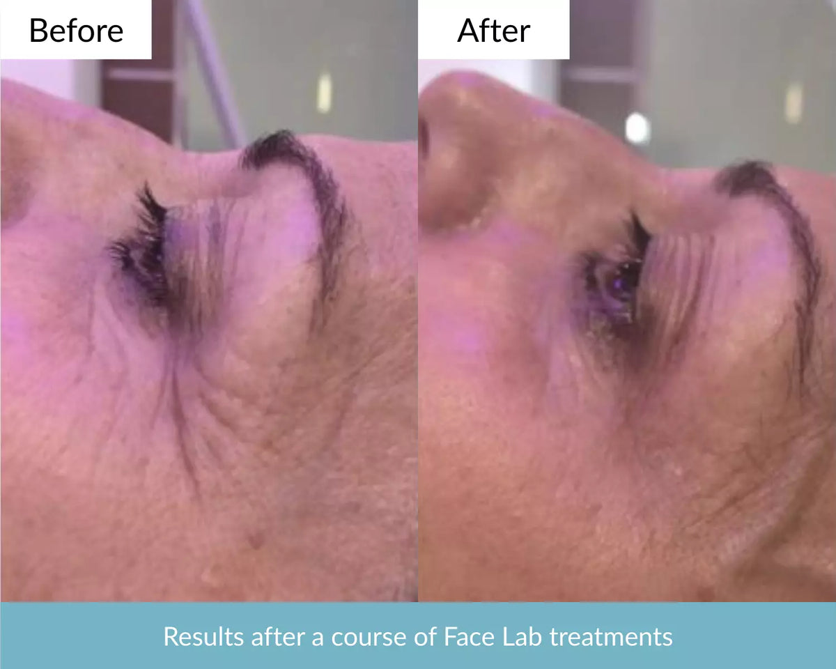 Infinity Face Lab
