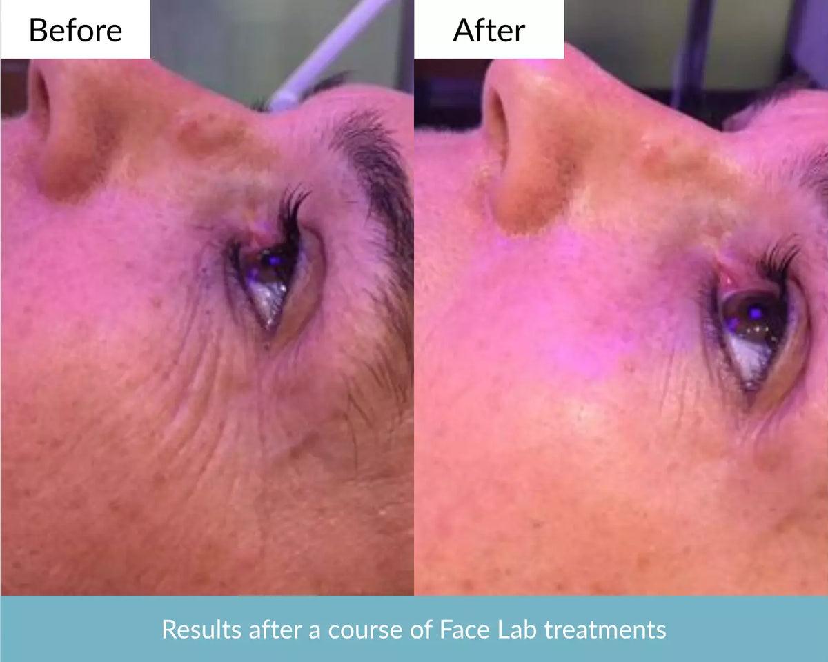 Infinity Face Lab