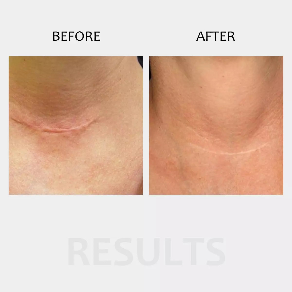 mccosmetics Dermapen