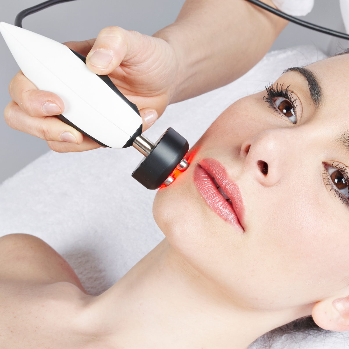 Multipolar Radio Frequency Face Handpiece for Overline