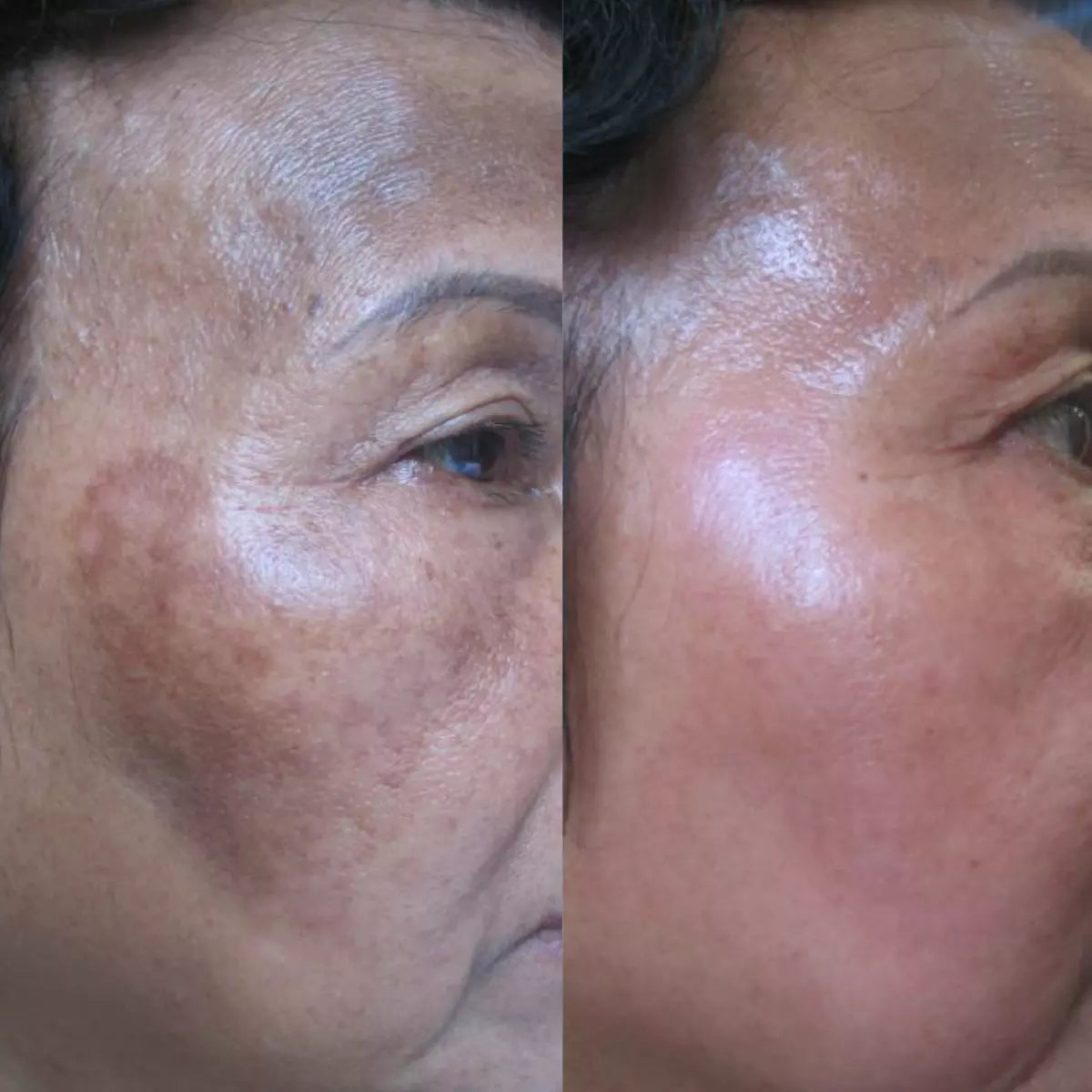 mccosmetics Melanopeel Professional Kit