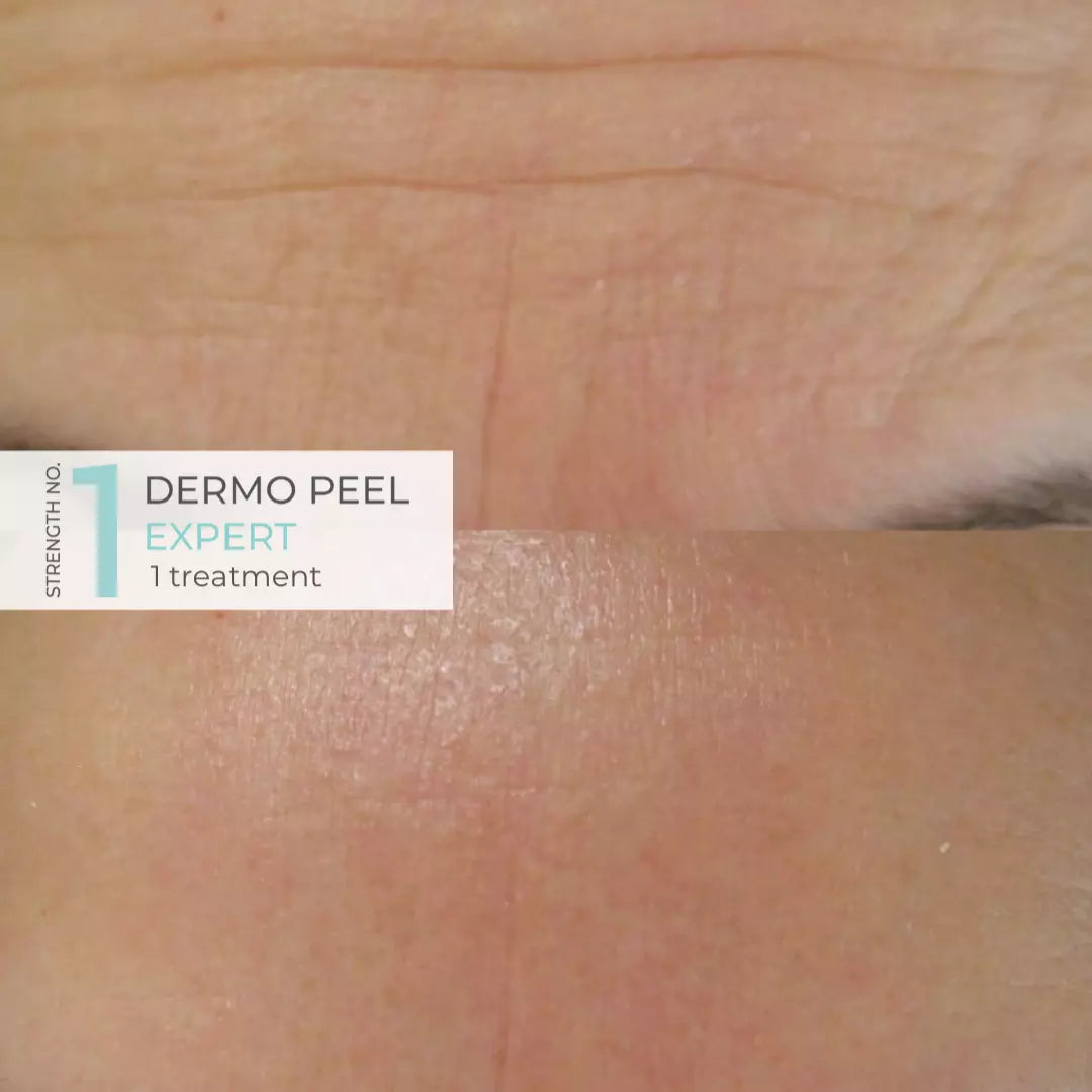 Anesi Lab Dermo Peel Expert - Strength No.1