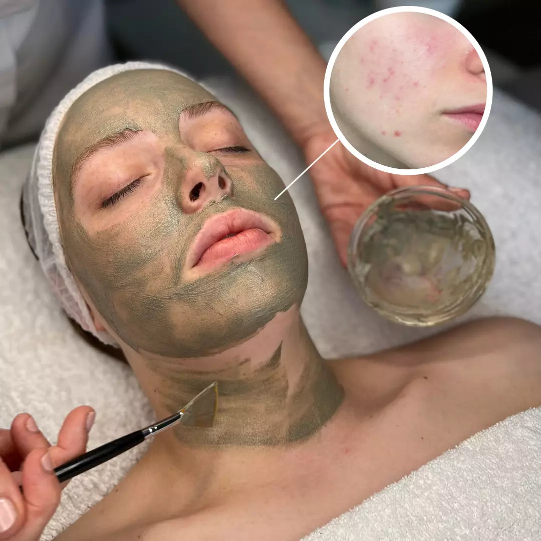 Anesi Lab Dermo Peel Renewal - Strength No.3